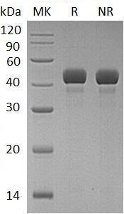 Human RCN3/UNQ239/PRO272 (His tag) recombinant protein