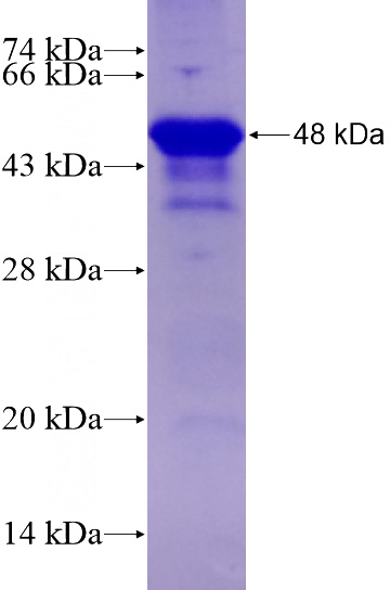 Recombinant Human BCL11A SDS-PAGE