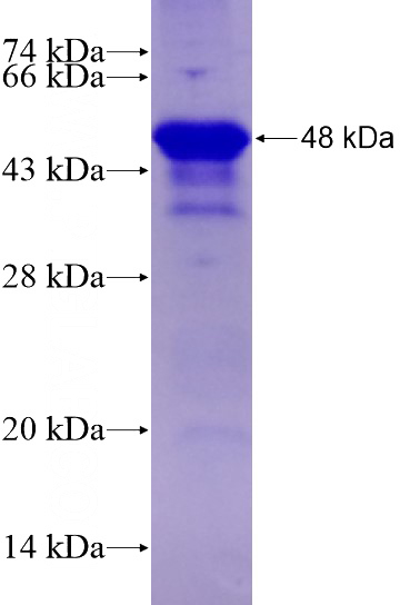 Recombinant Human BCL11A SDS-PAGE