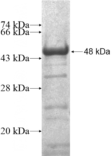 Recombinant Human SHD SDS-PAGE