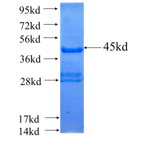 Recombinant human ADAMTS18 SDS-PAGE