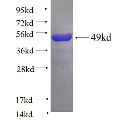 Recombinant human RAB24 SDS-PAGE