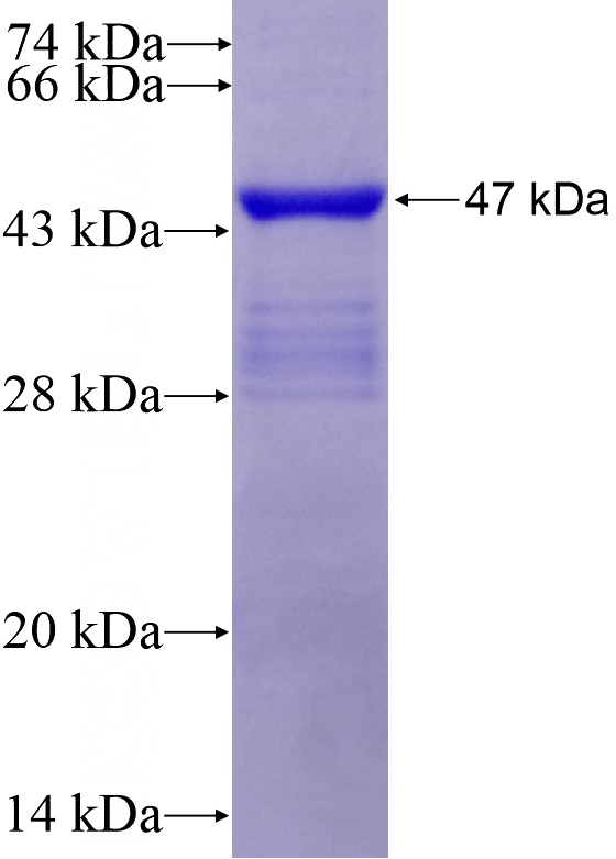 Recombinant Human CD11B SDS-PAGE