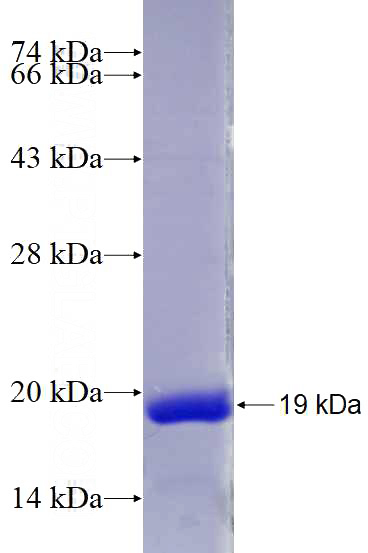 Recombinant Human CHRAC1 SDS-PAGE