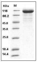 Influenza A H3N2 (A/Brisbane/10/2007) Hemagglutinin / HA Protein (His Tag) SDS-PAGE