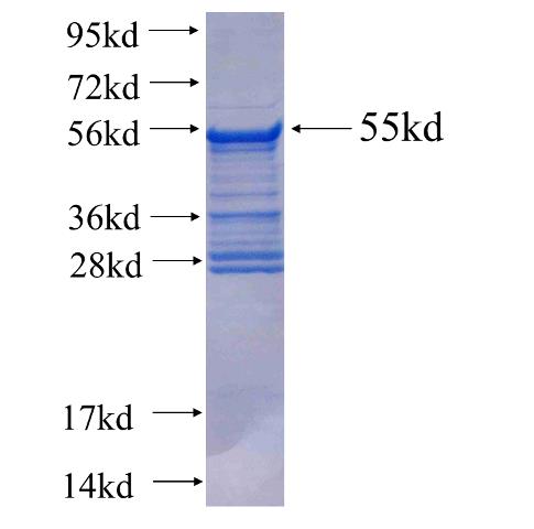 Recombinant human CEBPB(Full length) SDS-PAGE