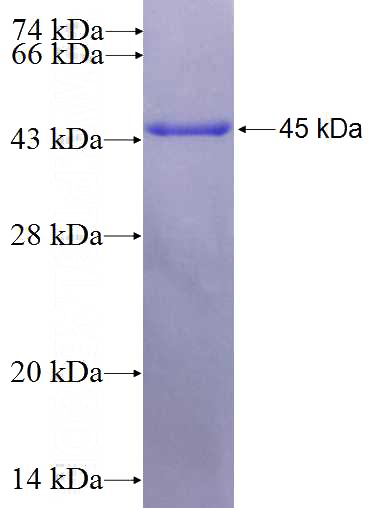 Recombinant Human PSMG1 SDS-PAGE