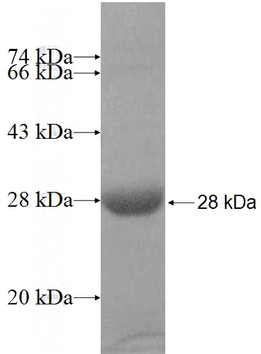 Recombinant Human RAB3B SDS-PAGE