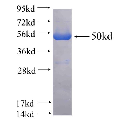 Recombinant human RAP1GAP SDS-PAGE