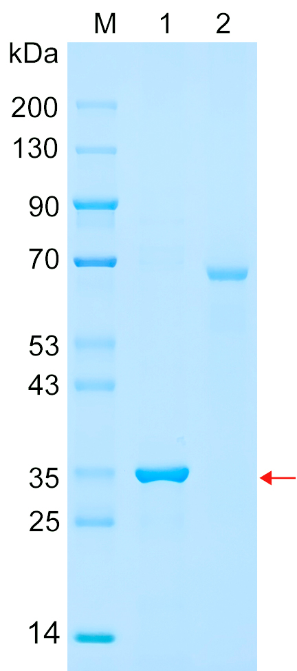 Recombinant PIM1 protein (His tag) SDS-PAGE
