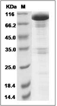Cynomolgus EphB1 / EPHT2 Protein (Fc Tag) SDS-PAGE