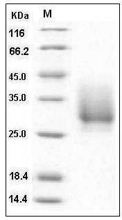 Human CD147 / EMMPRIN / Basigin Protein (His Tag) SDS-PAGE