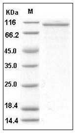 Human Angiopoietin-2 / ANG2 Protein (Fc Tag) SDS-PAGE