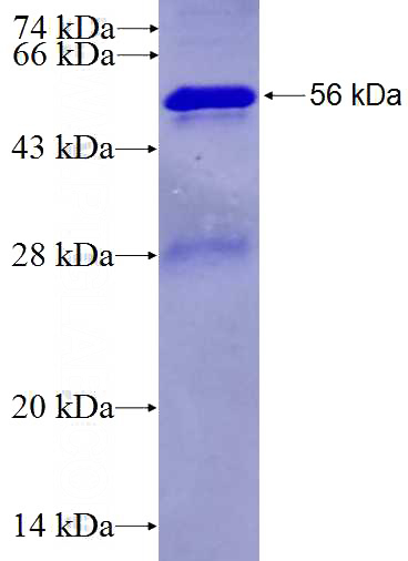 Recombinant Human RPS3A SDS-PAGE