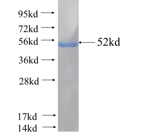 Recombinant Arabidopsis thaliana MVD1 SDS-PAGE