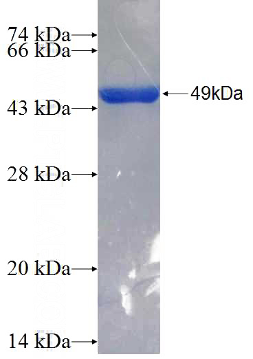 Recombinant Human LPCAT2 SDS-PAGE