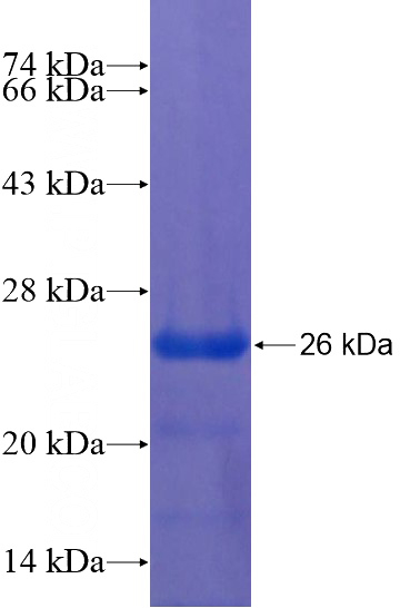 Recombinant Human EN2 SDS-PAGE