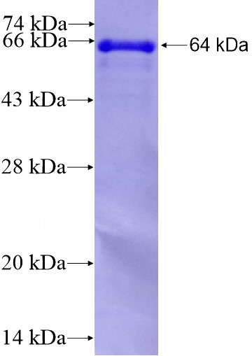 Recombinant Human FASTKD2 SDS-PAGE