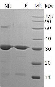 Human PRDX6/AOP2/KIAA0106 (His tag) recombinant protein