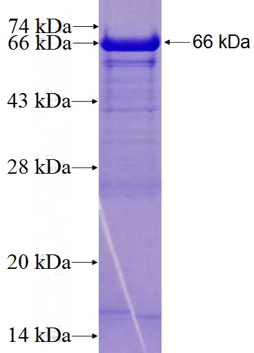 Recombinant Human CCP1 SDS-PAGE