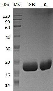 Mouse Cst6/mCG_11738 (His tag) recombinant protein