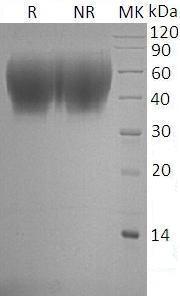 Mouse Cd86 (His tag) recombinant protein