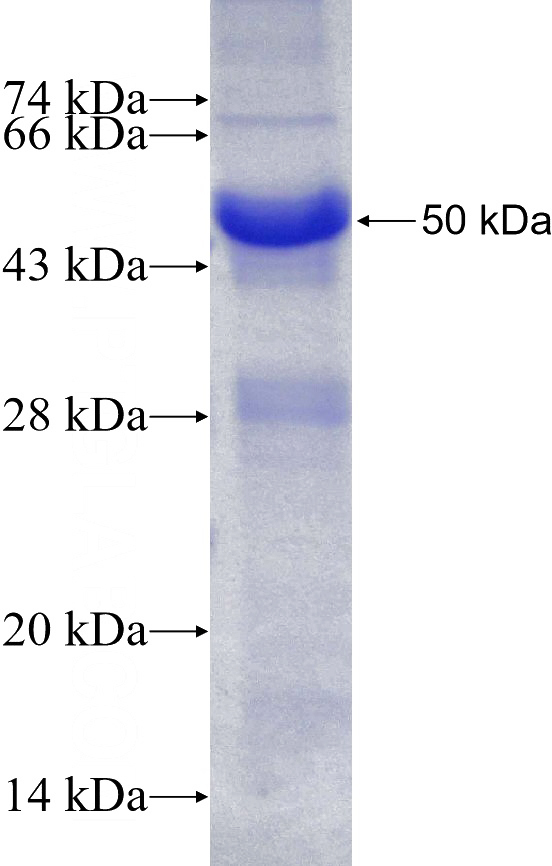 Recombinant Human KIF11 SDS-PAGE