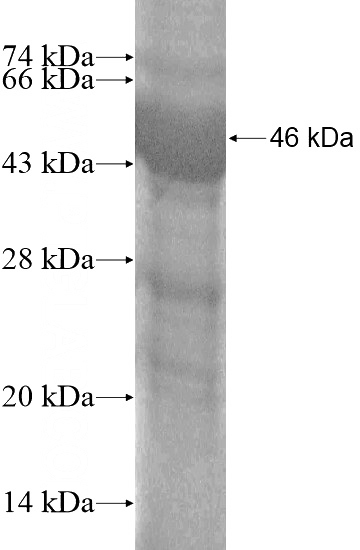Recombinant Human C1RL SDS-PAGE
