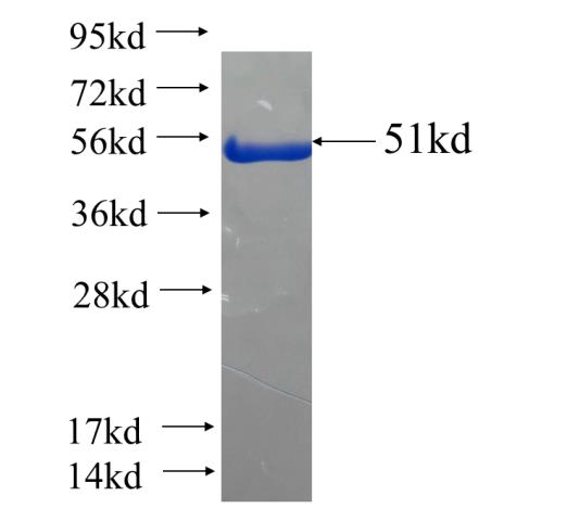 Recombinant human CCDC102A SDS-PAGE