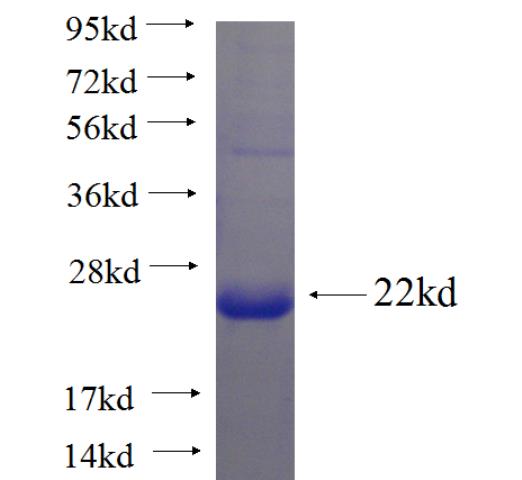 Recombinant human RTN4RL2 SDS-PAGE