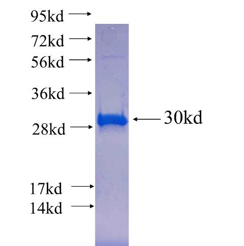 Recombinant human GPRC5B SDS-PAGE