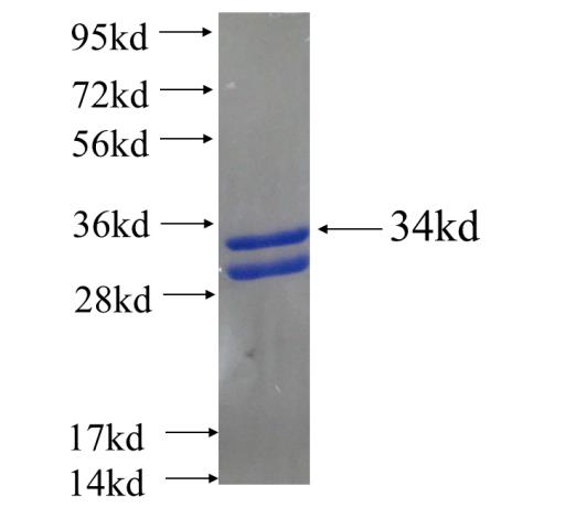 Recombinant human MSX2 SDS-PAGE
