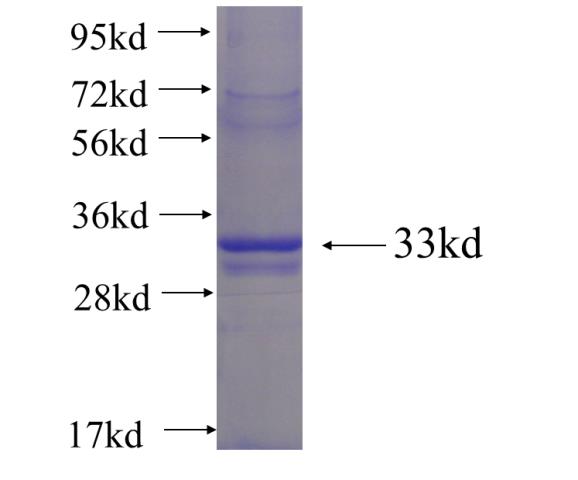 Recombinant human PTCD2 SDS-PAGE