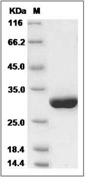 Human Serum amyloid P component / APCS / SAP Protein (His Tag) SDS-PAGE