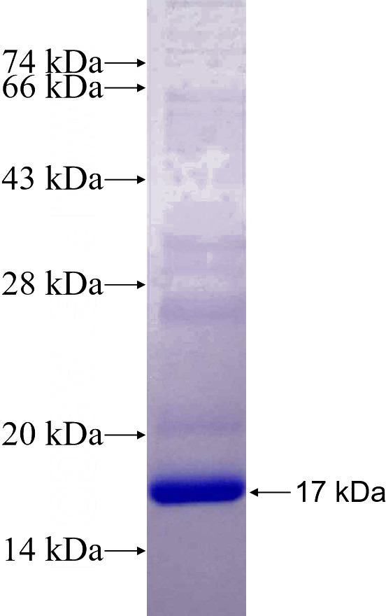 Recombinant Human PHF17 SDS-PAGE