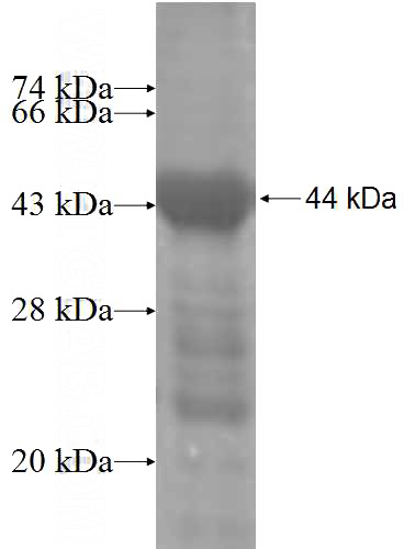 Recombinant Human MAP3K7IP3 SDS-PAGE