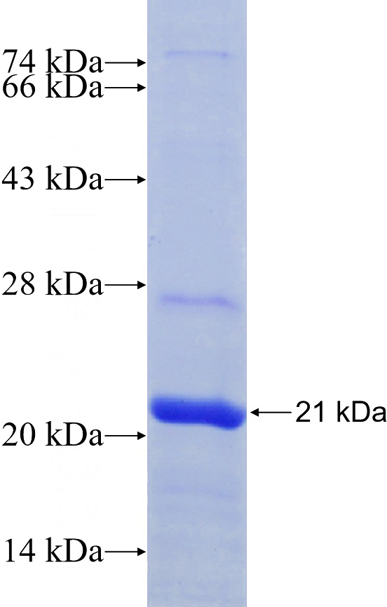 Recombinant Human PINK1 SDS-PAGE
