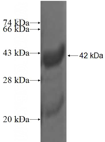 Recombinant Human ISCA2 SDS-PAGE