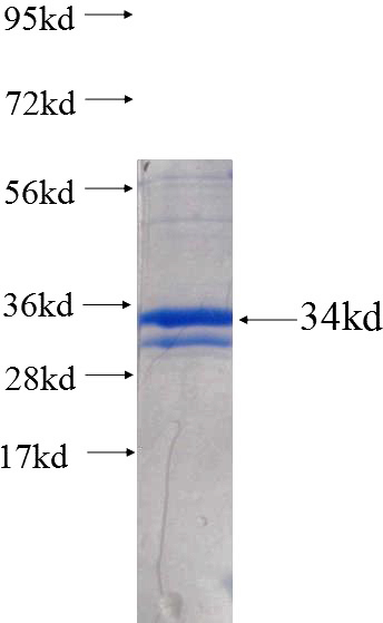 Recombinant Human JAK1 SDS-PAGE