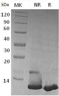 Human CCL23/MIP3/MPIF1/SCYA23 recombinant protein