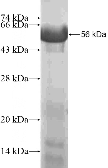 Recombinant Human TCHHL1 SDS-PAGE