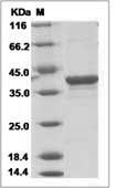 Ebola virus EBOV (subtype Bundibugyo, strain Uganda 2007) VP40 / Matrix protein VP40 Protein (His Tag)