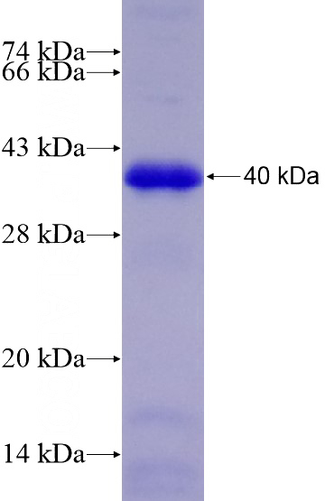 Recombinant Human SPRY2 SDS-PAGE