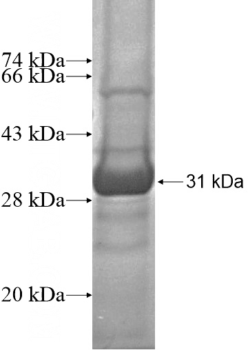 Recombinant Human GRPEL2 SDS-PAGE
