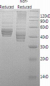 Human IL12B/NKSF2 recombinant protein