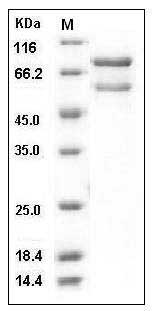 Human CAMK2B / CaMKII-beta Protein (His & GST Tag) SDS-PAGE
