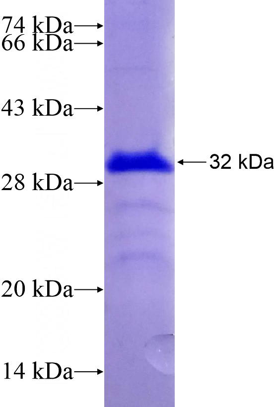 Recombinant Human MRPS34 SDS-PAGE