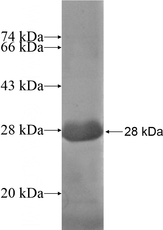 Recombinant Human FEZ2 SDS-PAGE