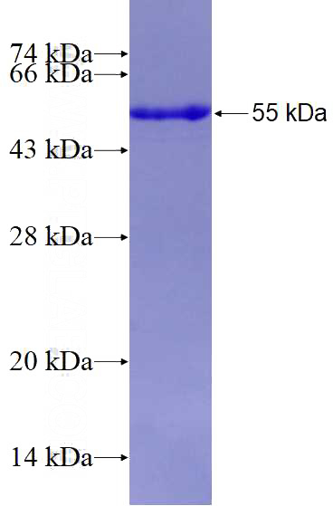Recombinant Human KRT10 SDS-PAGE