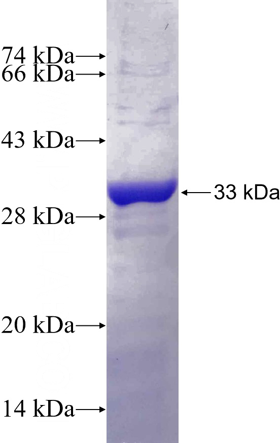 Recombinant Human KCNRG SDS-PAGE